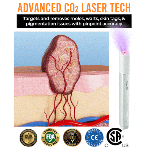 ✨QIAWI™ All-in-One CO₂ Laser Eraser Pen | Removes Moles, Warts, Skin Flaws & Pigmentation